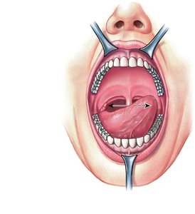 Anterior view of the oral cavity