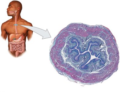 Transverse section of the esophagus