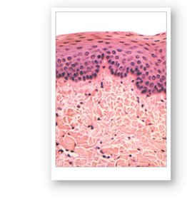 Histology of the esophageal mucosa