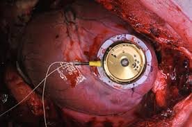 AV node location in the heart