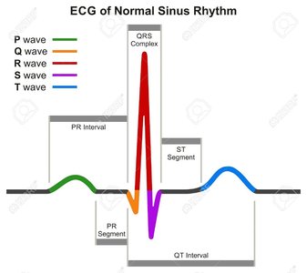 12-lead ECG