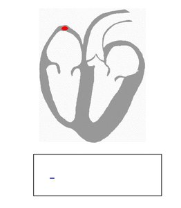 ECG waves and segments