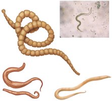 Various parasitic worms
