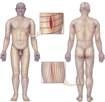 Cleavage lines of the skin