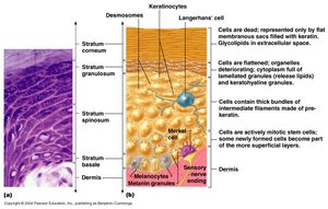 Histological section and diagram of epidermal layers