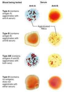 Blood typing agglutination reactions