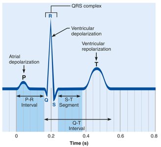 ECG tracing with labeled waves and intervals