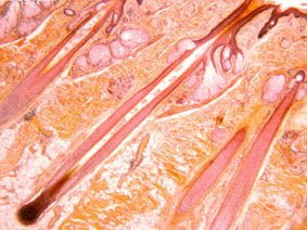 Histological section showing hair follicle and associated structures