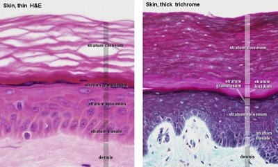 Histological comparison of thin and thick skin showing epidermal layers