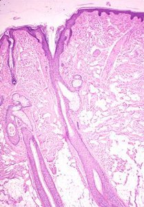 Histological section showing thick and thin skin