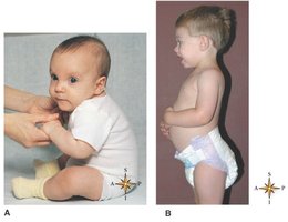 Development of spinal curvatures in infancy and early childhood