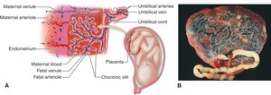 Placenta structure and maternal-fetal interface
