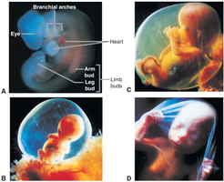 Human embryos and fetuses at various stages