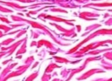 Collagen fibers in connective tissue