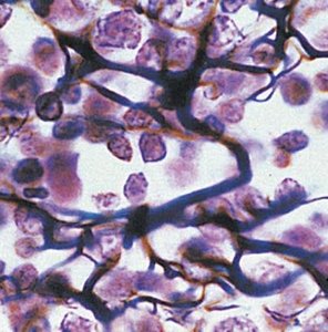 Reticular fibers in connective tissue
