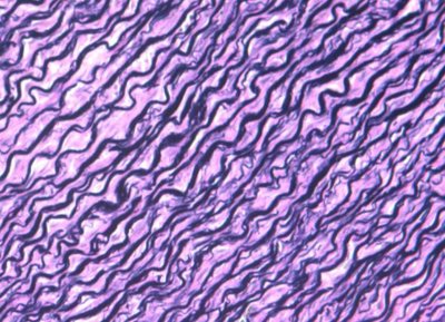 Elastic fibers in connective tissue