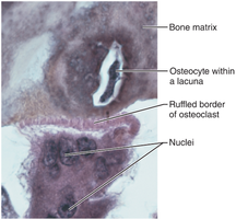 Osteoclast under microscope
