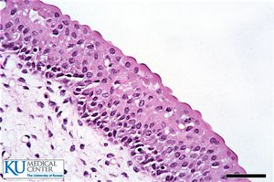 Histological section of transitional epithelium