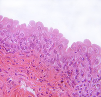 Empty bladder with transitional epithelium