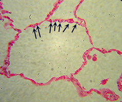 Micrograph of simple squamous epithelium in the lung