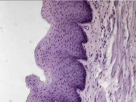 Histological section of stratified squamous epithelium
