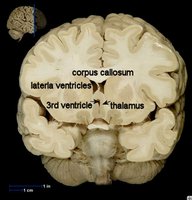 Histological section showing gray and white matter in the cerebellum