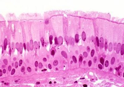 Photomicrograph of pseudostratified columnar epithelium