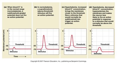 Effects of normokalemia, hyperkalemia, and hypokalemia on action potential threshold