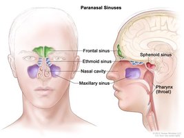 Diagram of paranasal sinuses in the skull
