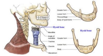 Diagram of the hyoid bone and its anatomical location.