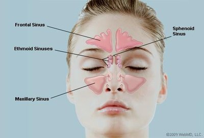 Diagram showing the location of the four major paranasal sinuses.