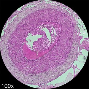 Simple squamous epithelium in blood vessel