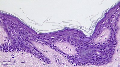 Stratified squamous epithelium