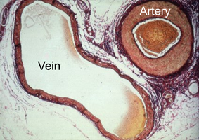 Histological comparison of artery and vein