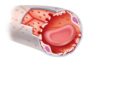 Fenestrated capillary structure
