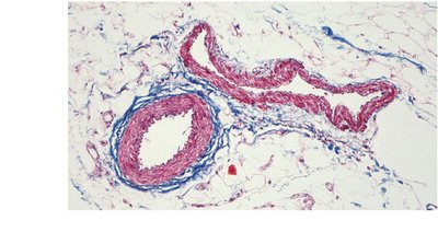 Artery and vein comparison