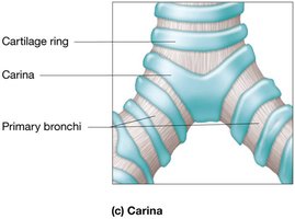 Carina of the trachea