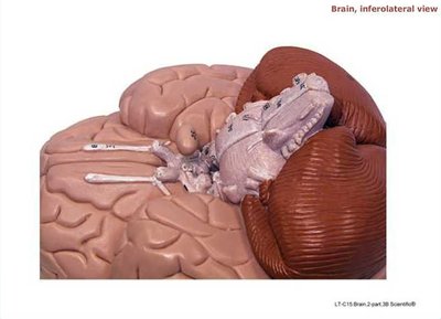 Brain, inferolateral view