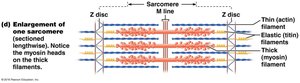 Enlargement of sarcomere and myofilament arrangement