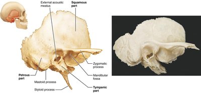 Photograph of the temporal bone
