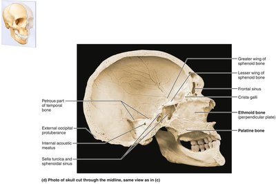 Bony boundaries of the orbits and nasal cavity