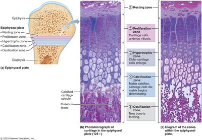Epiphyseal plate zones and bone growth