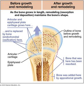 Bone growth and remodeling before and after