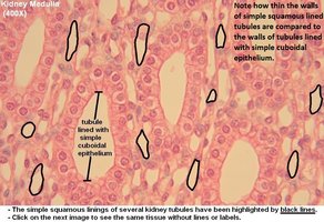 Histology of skin showing epidermal layers