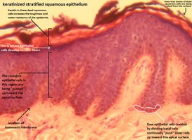 Keratinized stratified squamous epithelium