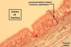 Pseudostratified ciliated columnar epithelium in trachea