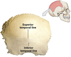 Parietal bone and temporal lines