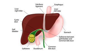 Bile composition and gallstones