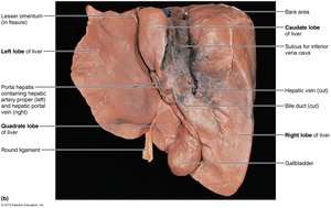Liver gross anatomy with labeled lobes and ligaments