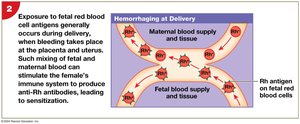 HDN: Sensitization at delivery